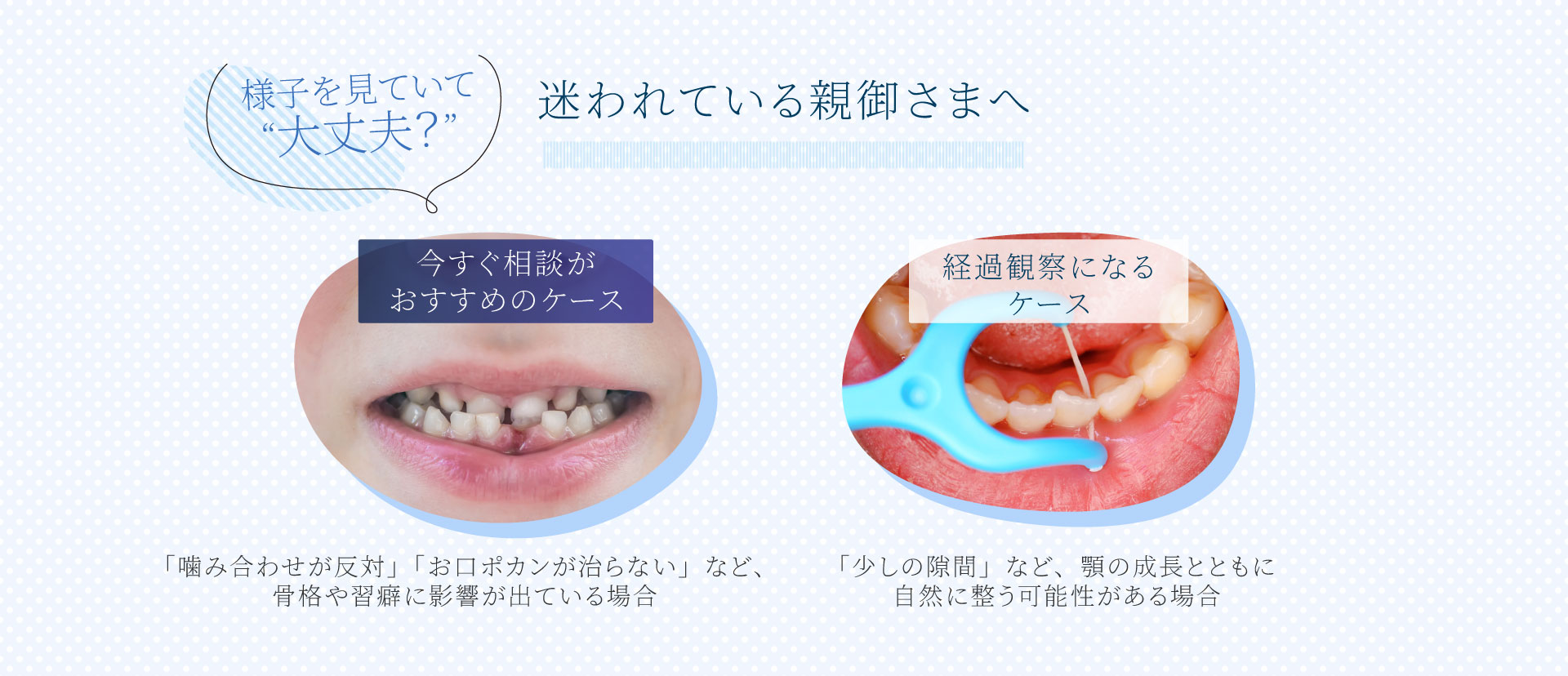 小児矯正を迷われている親御さまへ（PC）