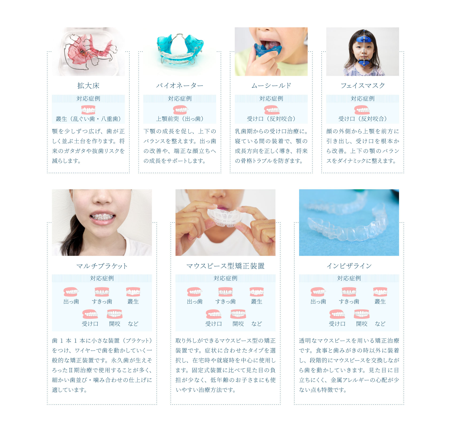 小児矯正治療について（PC）