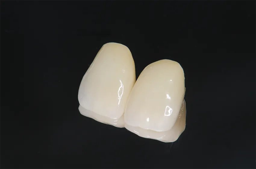 審美歯科 ハイブリッド型セラミックス|岡山市北区の歯医者【グラン岡山歯科・矯正歯科】インプラントから虫歯治療まで幅広く対応