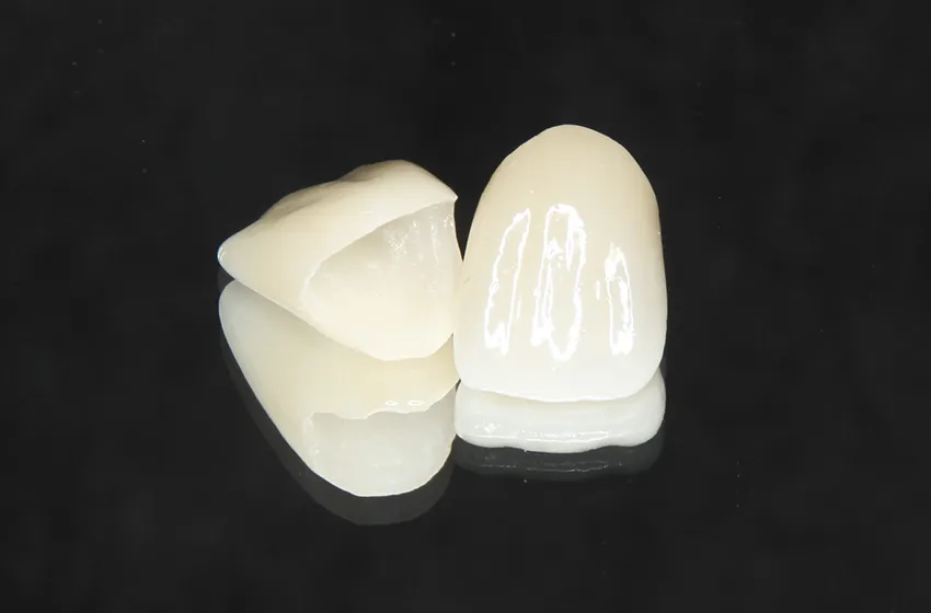 審美歯科 オールセラミックス|岡山市北区の歯医者【グラン岡山歯科・矯正歯科】インプラントから虫歯治療まで幅広く対応