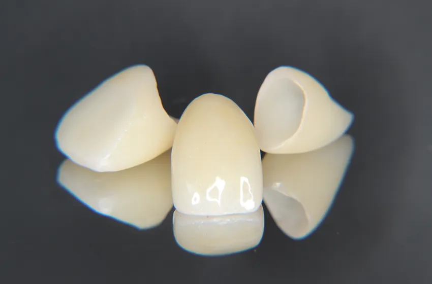 審美歯科 ジルコニア|岡山市北区の歯医者【グラン岡山歯科・矯正歯科】インプラントから虫歯治療まで幅広く対応