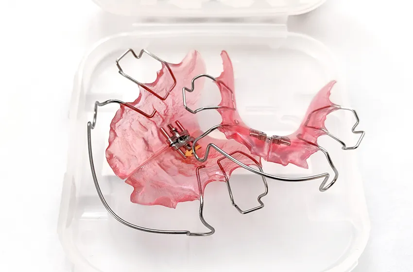 小児矯正 拡大床|成長に合わせた治療|岡山市北区の歯医者【グラン岡山歯科・矯正歯科】インプラントから虫歯治療まで幅広く対応